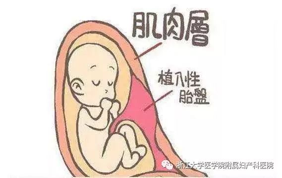 生孩子大出血概率很高吗,生孩子大出血最好的解决办法