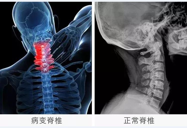 双11养生操,双11免费保养项目