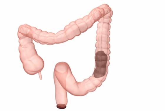 便秘是怎么回事能看好吗,便秘的表现与症状怎么解决