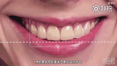 牙齿矫正8月最新价格,2024年30岁牙齿矫正费用多少钱