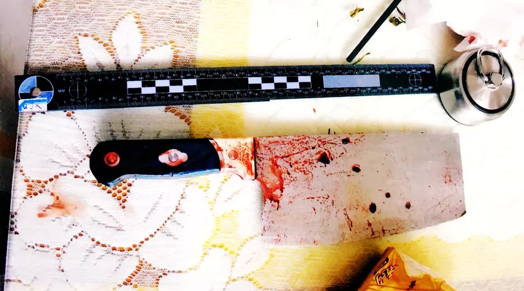 精神病人伤人有没有酌情处理,精神病人有伤人倾向怎么处理