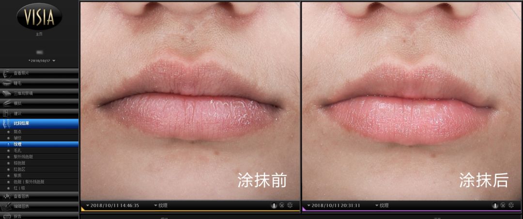 唇炎适合涂的唇膏推荐,四季唇干起皮用什么唇膏最好