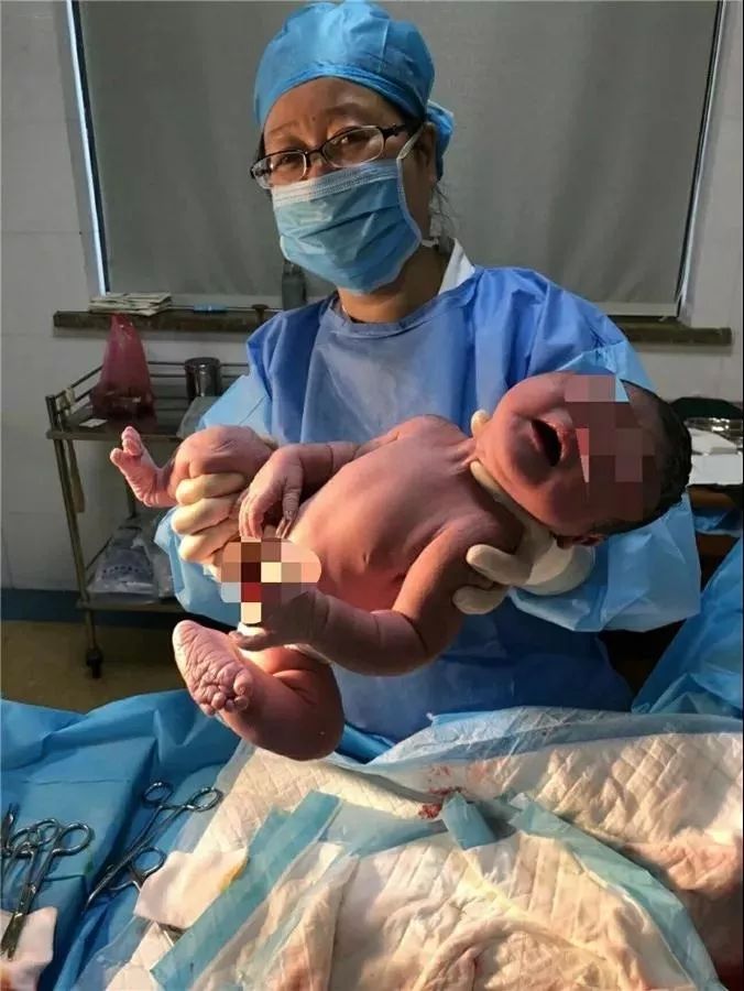 平湖准妈妈住院待产，胎儿胎心突然消失！千钧一发之际……