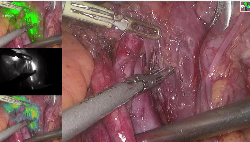 术中监测,术中监测仪