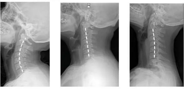 拯救你的颈椎!这款德国变态”护颈”神器,让你坐着比躺着还舒服,连失眠也能救一下
