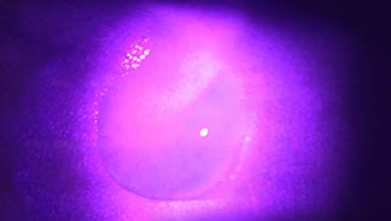 适合黄皮干皮用的面膜,黄皮黑皮适合用的面膜