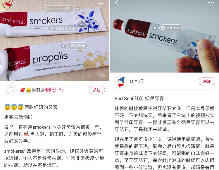 花了1300元做了一个牙冠,花了两万块钱做的牙齿