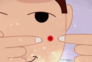 针清痘痘多少钱,针清脓包型痘痘