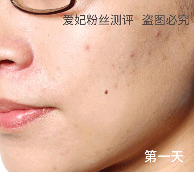 大s到底怎么美白的呢,大s美白秘诀内调测评