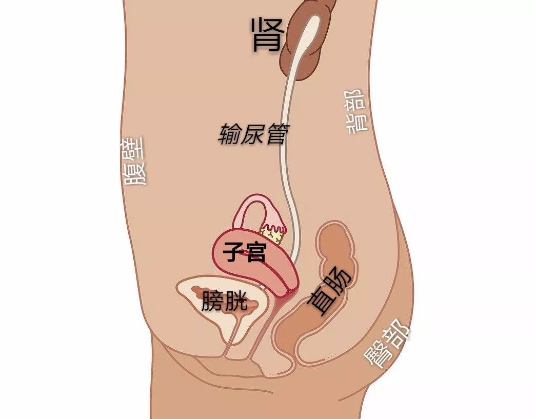 子宫肌瘤三件事,子宫肌瘤大包块