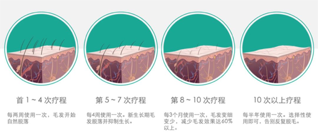腿部脱毛的最佳方法,男性脱毛的最佳方法