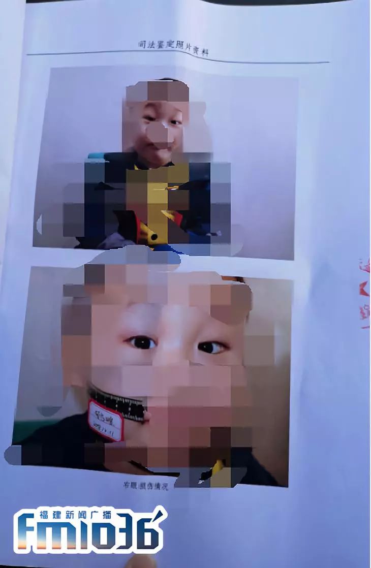 福建省幼儿园虐童事件,网上爆出了幼儿教师虐童事件