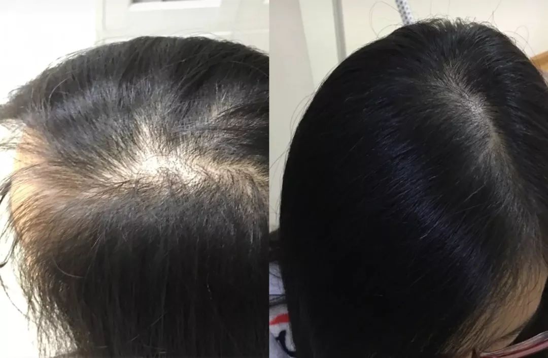 突然长了很多小碎发,额前碎发是新长出来的吗