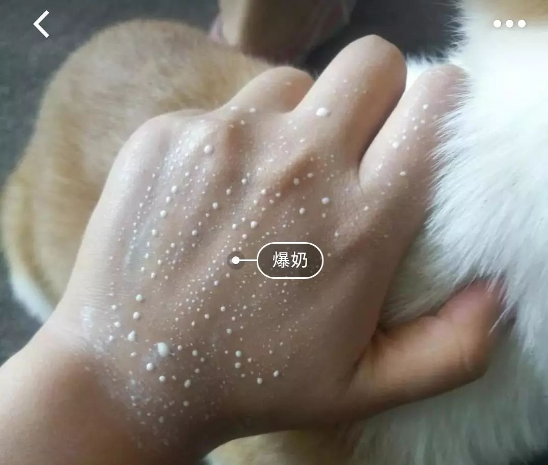 脱发算啥!90后已经开始长“老年斑”了,有人还为此花了10多万!