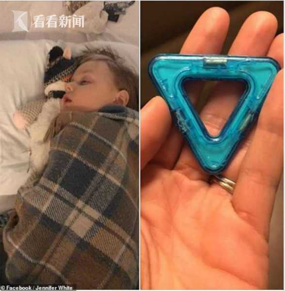 4岁小孩吞塑料积木,四岁熊孩子误吞了34颗磁力珠