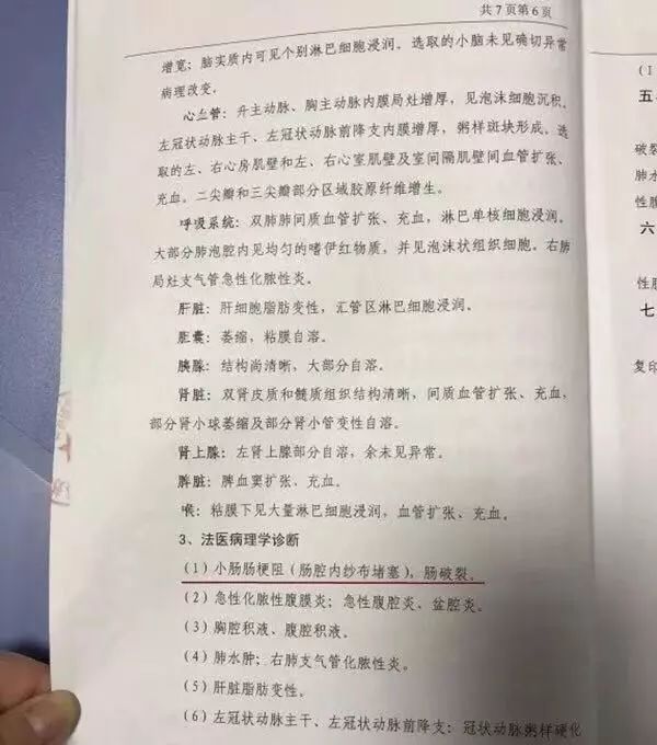 女子术后纱布留体内腹痛死亡,女子引产纱布留体内