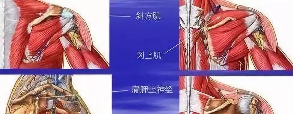 康复锻炼手麻是怎么回事,手麻的治疗思路这5个点要记住