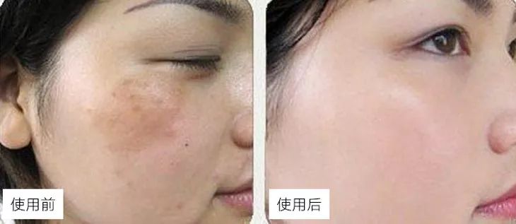 眼里写满故事脸上不见半点风霜,眼里写满故事脸上不见风霜的女子