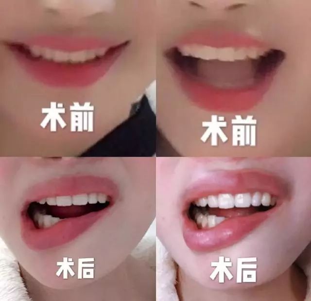 整容脸被打伤如何赔偿,整容10级伤残赔偿标准