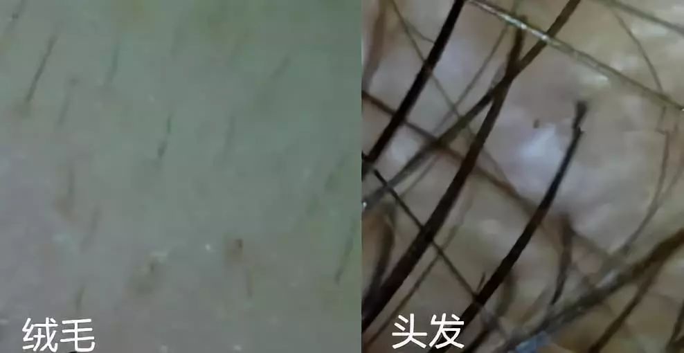 额前长小碎发,额前小碎发往后长