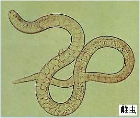 人感染旋毛虫后对人的危害有哪些,提醒别碰几种蔬菜寄生虫多到成堆