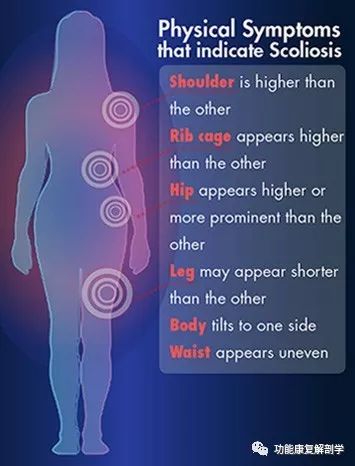 中小学生脊柱侧弯,脊柱侧弯怎么治疗