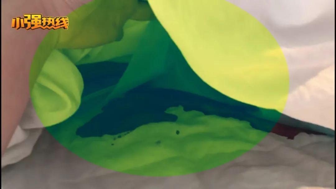 做完手术放血,手术成功术后出血死亡