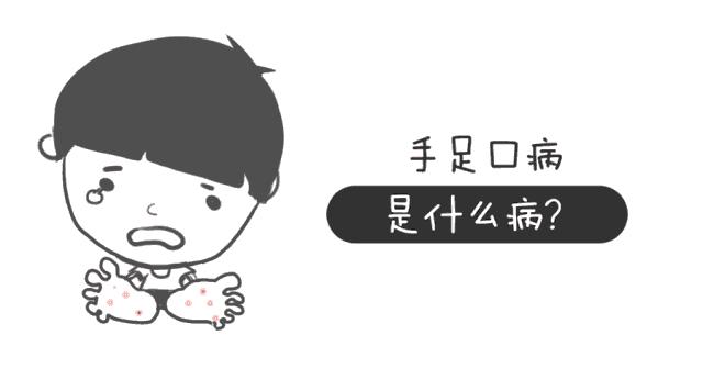手足口病要谨记什么,手足口病没有你想的那么可怕