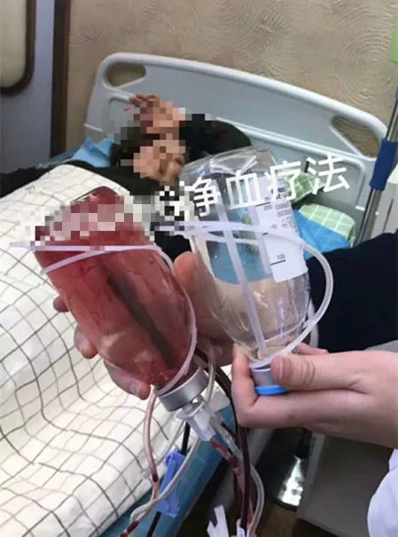 美容又“防癌”？女子竟然在体外“洗血”，这种医美太可怕……