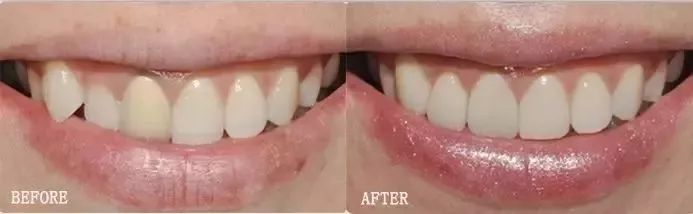 清新口气避免尴尬,拯救口气