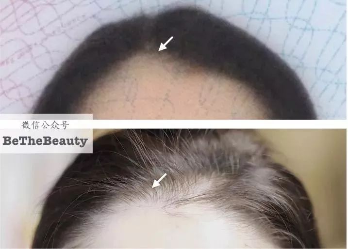 想为颜值偷偷加分？但只有10%的人会机智地修饰这里诶！