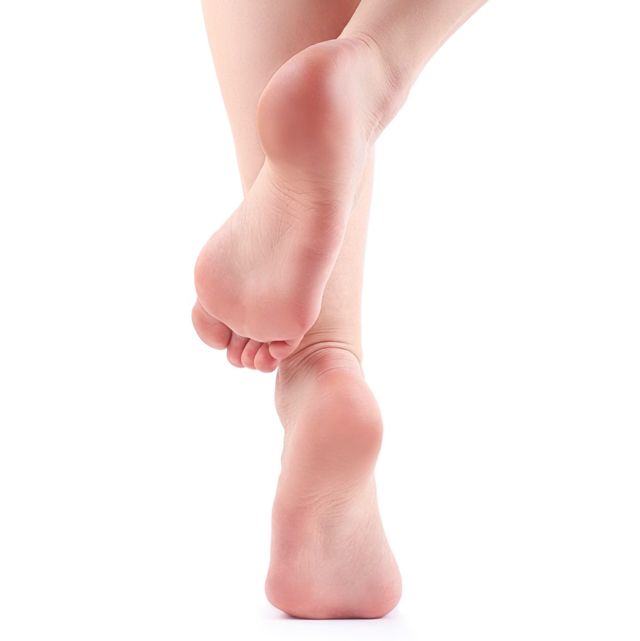 干裂的脚后跟图,干裂的脚后跟