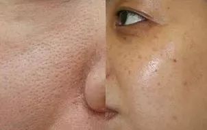 护肤小红书都在推荐的安瓶面膜,护肤补水推荐小红书