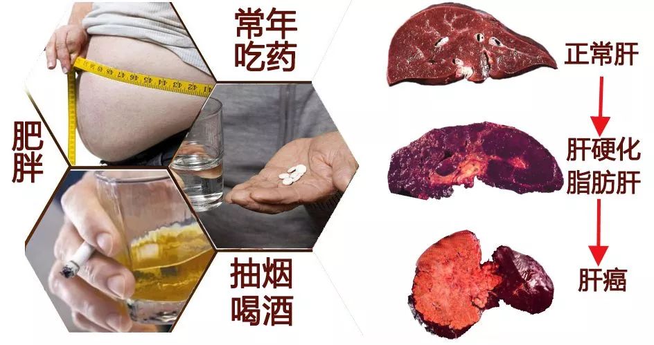 小心肝护肝茶有用吗,小心肝茶叶是什么茶