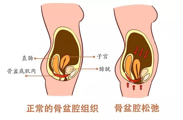 这款美臀神器这么“神”吗？
