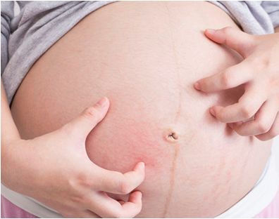 孕期白带黄有渣阴道痒用什么药,孕期外阴瘙痒医生给开的药