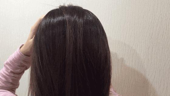 一个月不用洗头快速解决头油头屑,头油头屑多脱发用什么洗