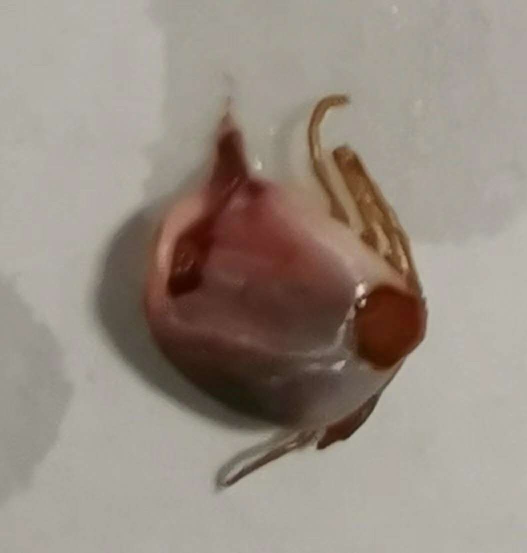 3岁女童头痒是什么原因,3岁女童头皮有红疙瘩一碰就疼