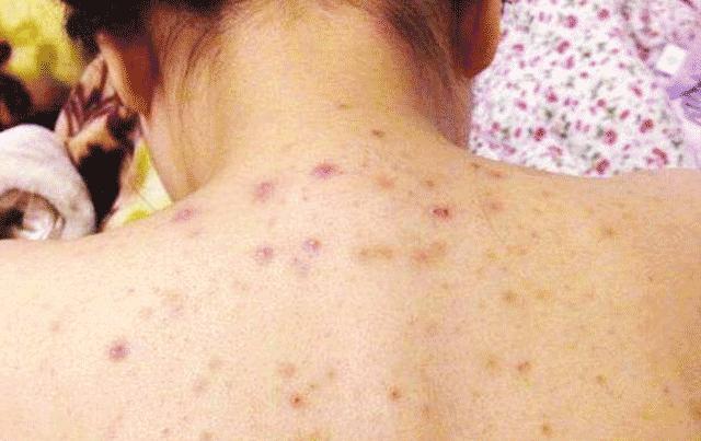 衣服收纳箱除臭留香,衣服收纳箱有异味怎么办