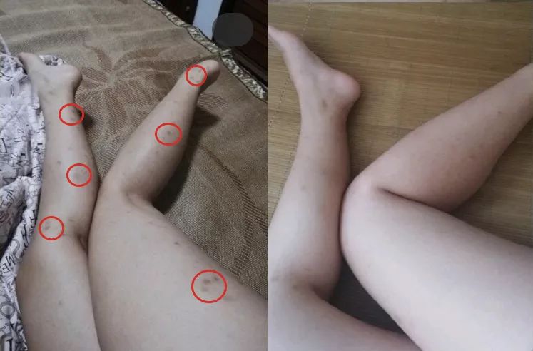 蚊子驱蚊驱虫,杀虫剂对蚊子有效又安全