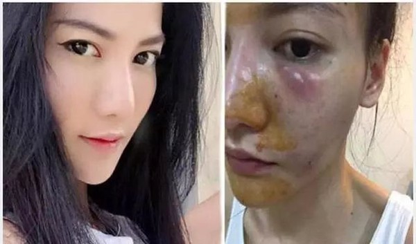 深扒美白成分不可不知的烟酰胺,市面的美白针