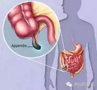 写给被我们割掉的子宫、扁桃体、胆囊、脾、卵巢、阑尾的祭文，割掉后果……