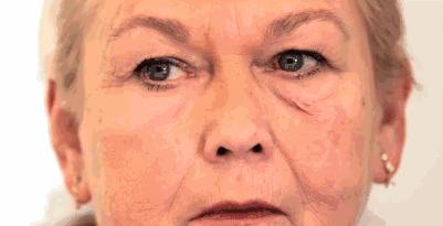 德国变态震动棒，啪啪啪间抚平眼袋、黑眼圈！不用开刀，就能让你年轻十岁！