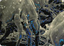 80岁妇科病与内裤有关系吗,80%的妇科问题