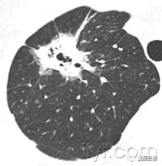 胸部解剖及常见疾病影像表现,胸部影像学基础知识