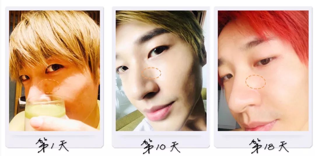 那些年你美白踩过的雷，我们都踩过！