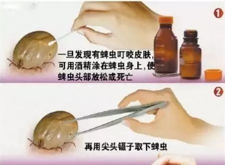 2岁男孩眼皮上突然冒出一个小黑点！医生：这东西会要命！眼下高发，别大意！