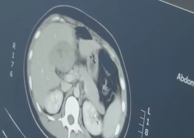 女子怀孕后到医院检查医生惊呆了,女子怀孕医生检查时吓坏了