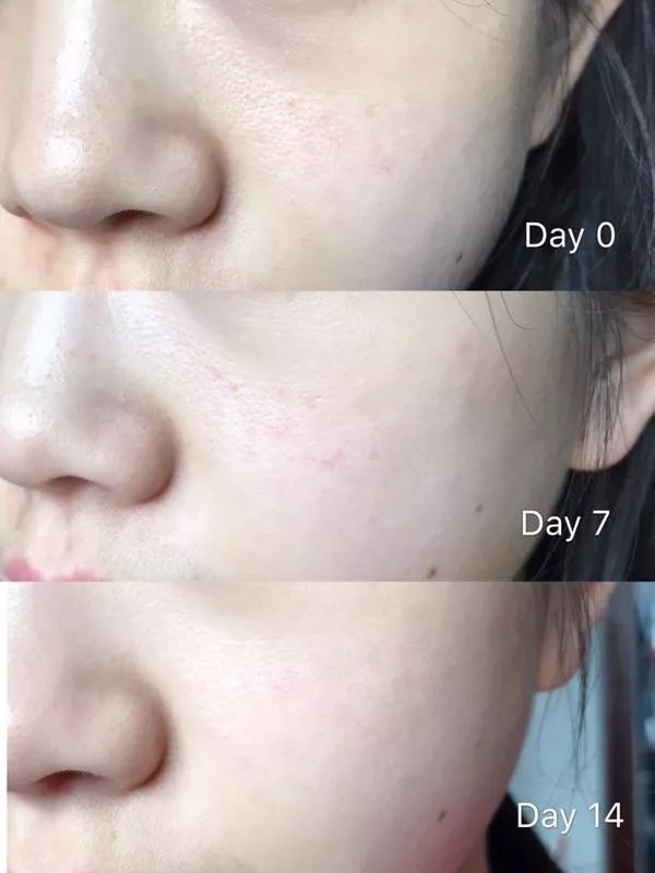 盲测14天揭密|年轻肌特训营收关，那瓶好评如潮的精华水究竟是谁？