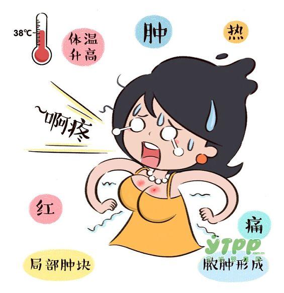 哺乳期乳腺炎如何判断已形成脓肿,哺乳期乳腺炎怎么判断脓肿